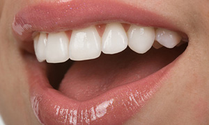 Cosmetic Dentistry, Katy, TX